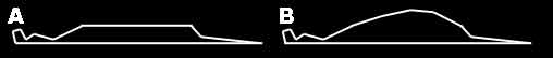 MTLn3_flattopdiagram.jpg